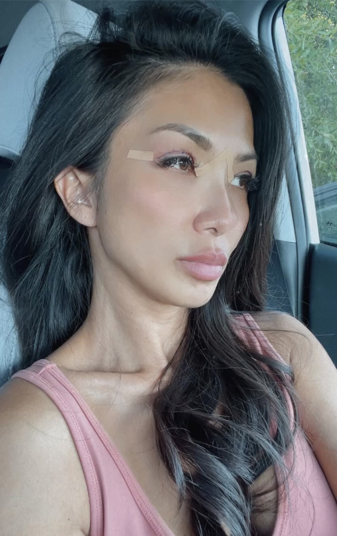 Patient Selfie